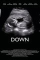 Down picture